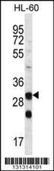 CA6 Antibody (C-term)