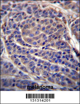 CA6 Antibody (C-term)