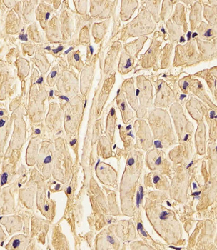 PLOD1 Antibody (N-term)
