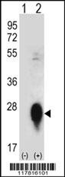 CLEC3B Antibody (Center)