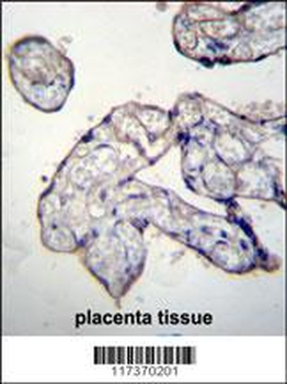 TRIP13 Antibody (C-term)