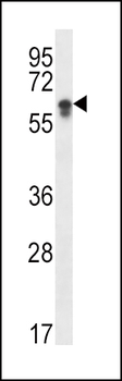 CYP2S1 Antibody (C-term)