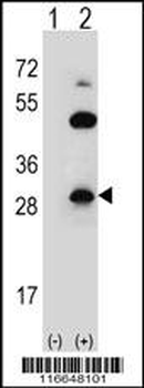 CLDN2 Antibody (C-term Y224)