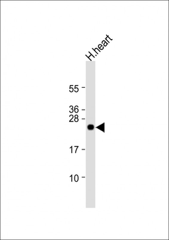 CLDN2 Antibody (C-term Y224)