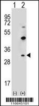 CLDN2 Antibody (C-term Y195)