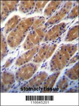 CLDN2 Antibody (C-term Y195)