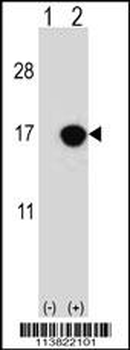 CDKN2B Antibody (C-term)
