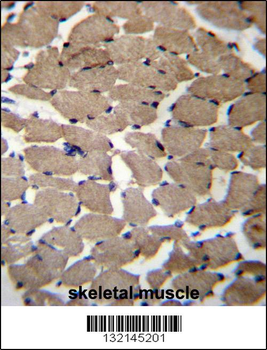 MGAT4C Antibody (C-term)
