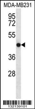 TMEM43 Antibody (Center)