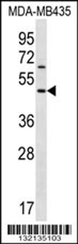 KERA Antibody (C-term)