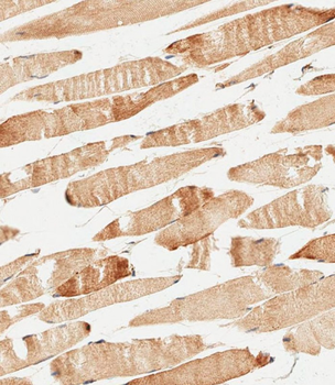KERA Antibody (C-term)