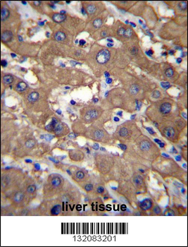 UGDH Antibody (C-term)