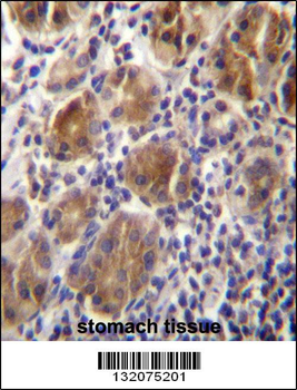 MLPH Antibody (C-term)