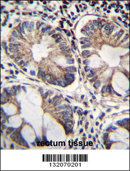 ME2 Antibody (C-term)