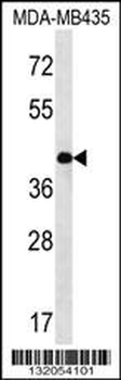 SERPINE2 Antibody (Center)