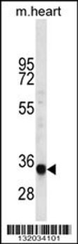 LIX1L Antibody (Center)