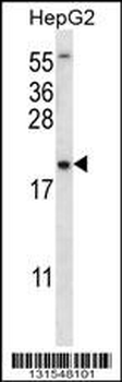 UBE2NL Antibody (N-term)