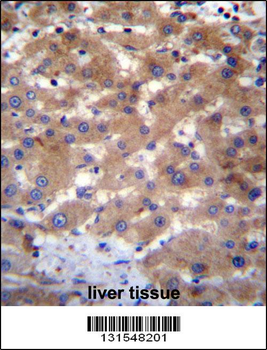UBE2NL Antibody (N-term)