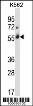 CBLC Antibody (C-term)