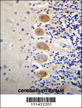 GP111 Antibody (Center)
