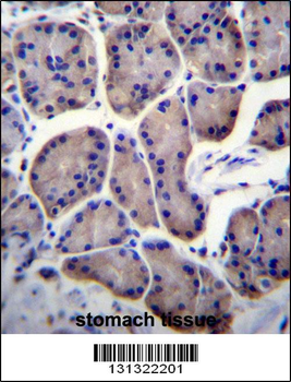 RPL23 Antibody (Center)