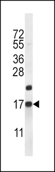 CARTPT Antibody (N-term)