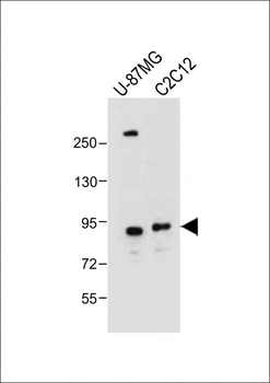 DTNA Antibody (C-term)