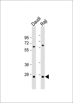PSMB10 Antibody (C-term)
