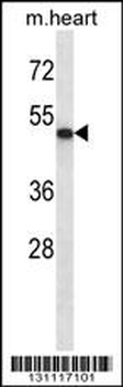 ABI2 Antibody (N-term)