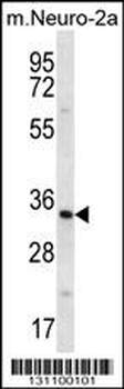 PEX14 Antibody (Center)