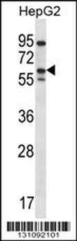 ERRFI1 Antibody (Center)