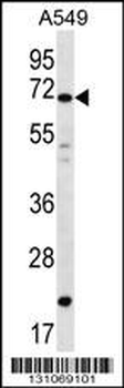 DAZ4 Antibody (Center)