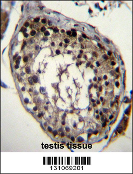 DAZ4 Antibody (Center)