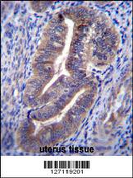 K1324 Antibody (C-term)