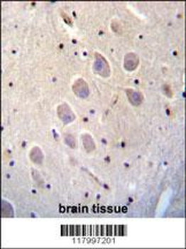 CD271 Antibody (C-term)
