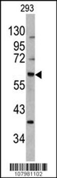 MDM2 Antibody (S166)