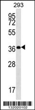 OR10H5 Antibody (C-term)