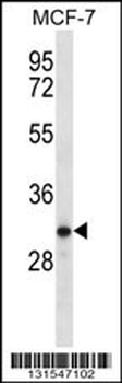 TESSP1 Antibody (Center)