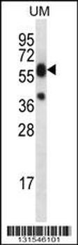 LIPM Antibody (C-term)