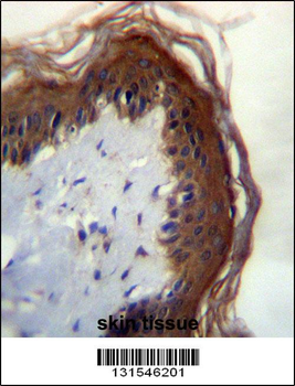 LIPM Antibody (C-term)