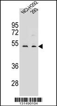 WDR86 Antibody (C-term)
