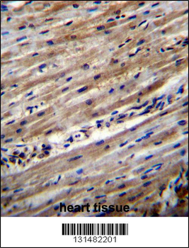 DUS1L Antibody (C-term)