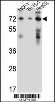 HSD17B4 Antibody (Center)