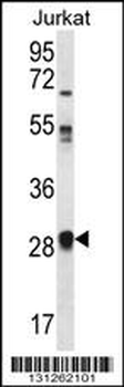 OR11L1 Antibody (C-term)