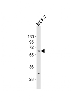 ZNF835 Antibody (N-term)