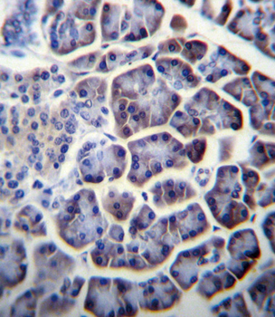 PC Antibody (N-term)