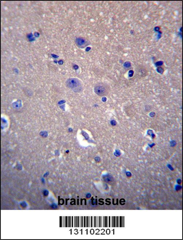 DNAJB6 Antibody (Center)