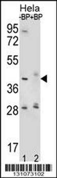 HYAL2 Antibody (Center)