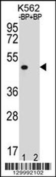 OR8K3 Antibody (C-term)