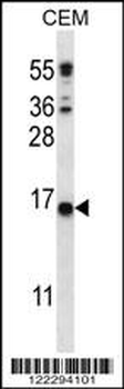 CJ057 Antibody (C-term)